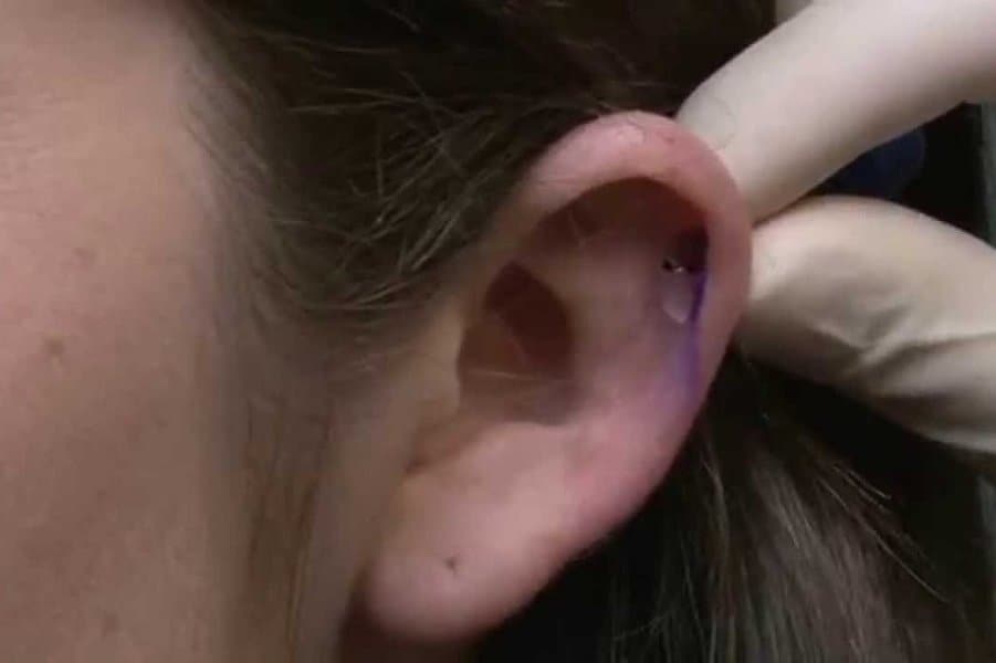 Auricle Piercing